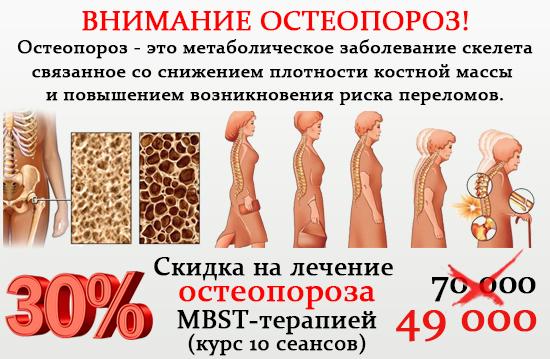 Скидка на лечение остеопороза MBST-терапией - 30%