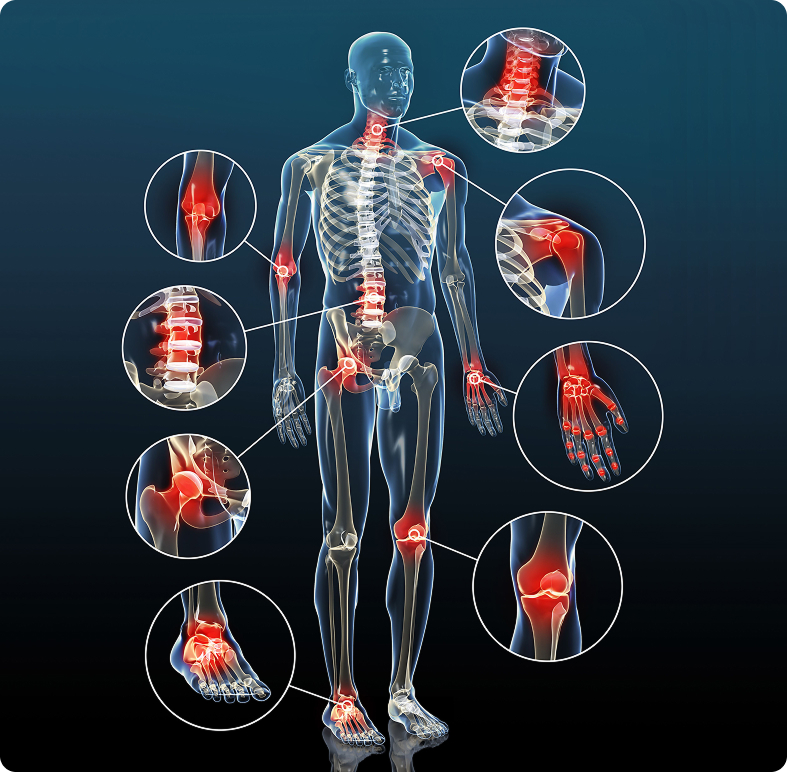 Схема суставов